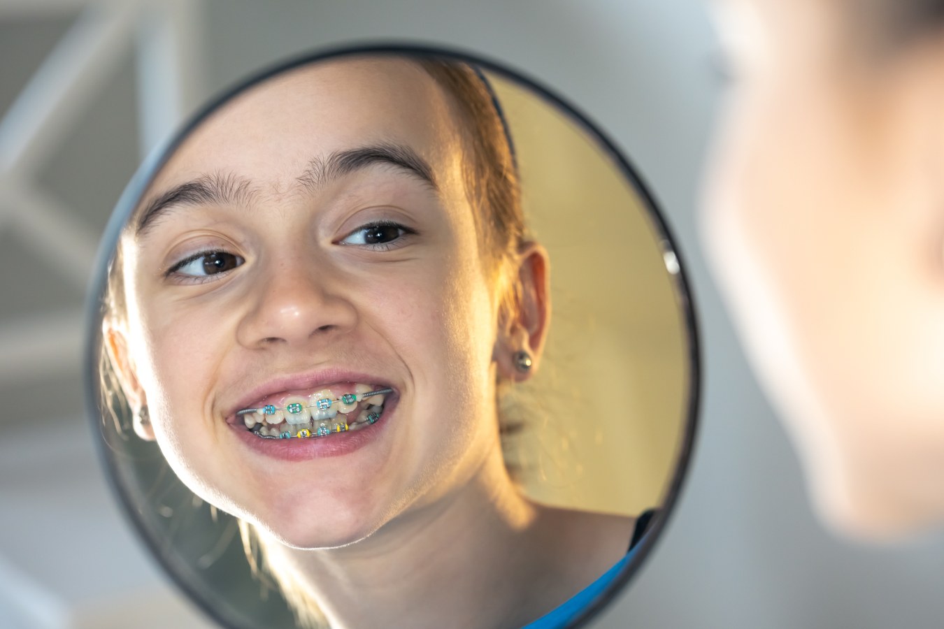 Braces for Kids